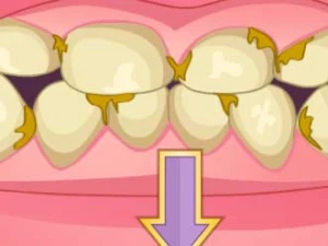 Bad Teeth Makeover - Play Free Best Dress-up Online Game on JangoGames.com