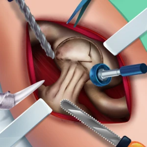 Ella Hip Surgery - Play Free Best Care Online Game on JangoGames.com