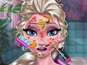 Ice Queen Skin Doctor - Play Free Best Dress-up Online Game on JangoGames.com