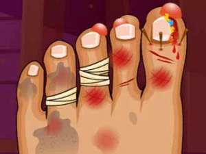 Monster Foot Doctor - Play Free Best Dress-up Online Game on JangoGames.com