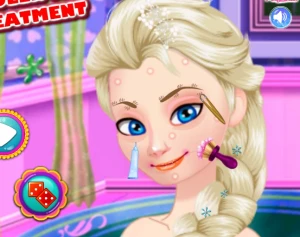 Ice Queen Acne Treatment - Play Free Best Care Online Game on JangoGames.com
